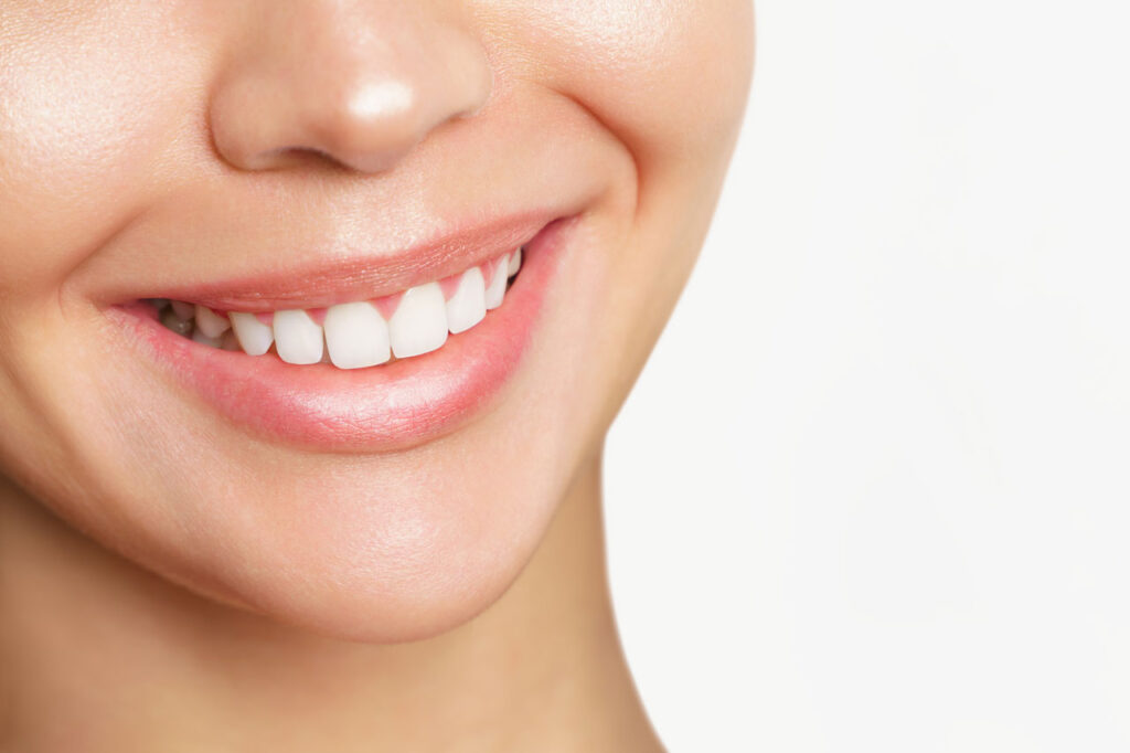 Sbiancamento dentale: scopri i 5 vantaggi che ancora non conoscevi